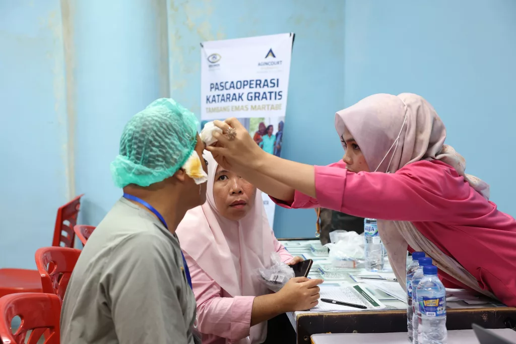 operasi-katarak-gratis-tambang-emas-martabe-2025-657-mata-satu-harapan-lihat-indahnya-dunia